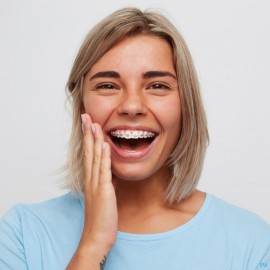 Vitis Orthodontic Access Tandenborstel 2880