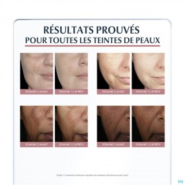 Eucerin A/pigment Dagcreme Ip30 50ml