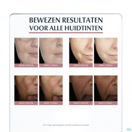 Eucerin A/pigment Dagcreme Ip30 50ml
