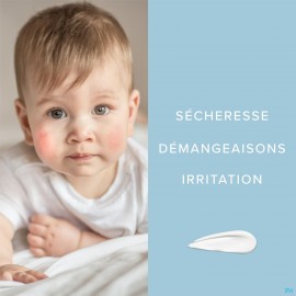 Dermalex atopic baby eczema crem 30 g