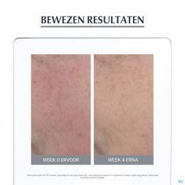 Eucerin Anti Redness Kalmerende Verzorging 50ml