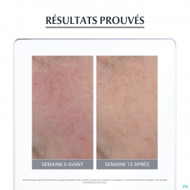 Eucerin Anti Redness Kalmerende Verzorging 50ml