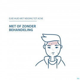 Ducray Keracnyl Schuimende Gel 400ml Nf