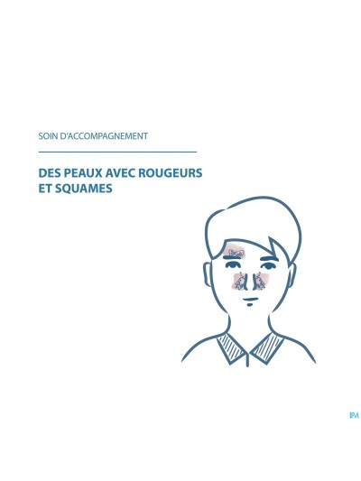 Ducray Kelual Ds Creme 40ml Nf