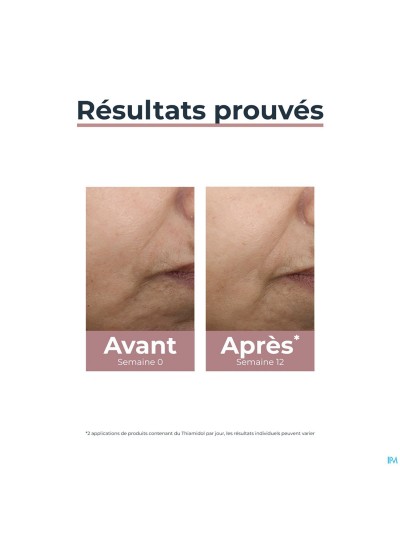 Eucerin A/pigment Dagcreme Tinted Ip30 Medium 50ml