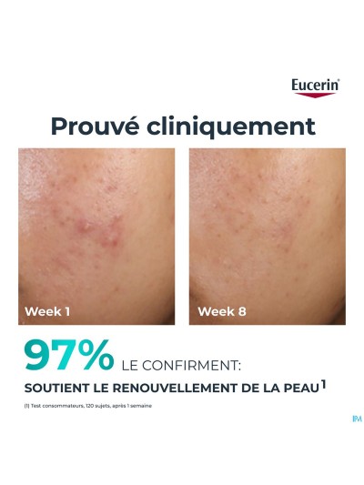 Eucerin Dermopure Clinic.peeling 10 Soin Nuit 40ml
