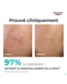 Eucerin Dermopure Clinic.peeling 10 Soin Nuit 40ml
