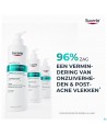 Eucerin Dermopure Clinic. Corriger.reiniger. 400ml